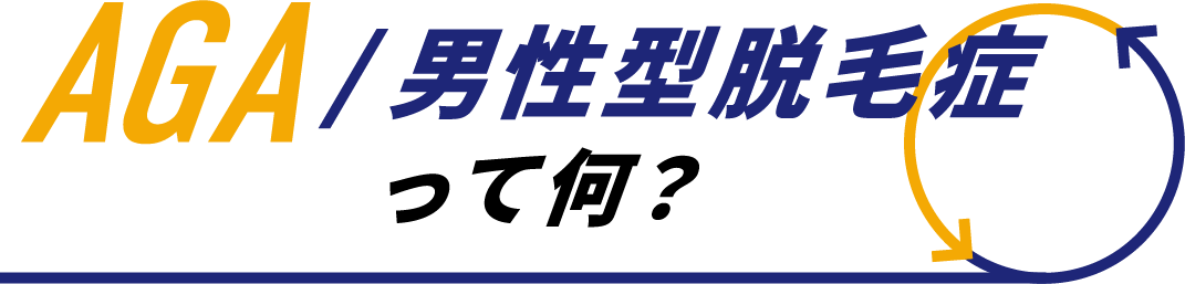 AGA/男性型脱毛症って何?